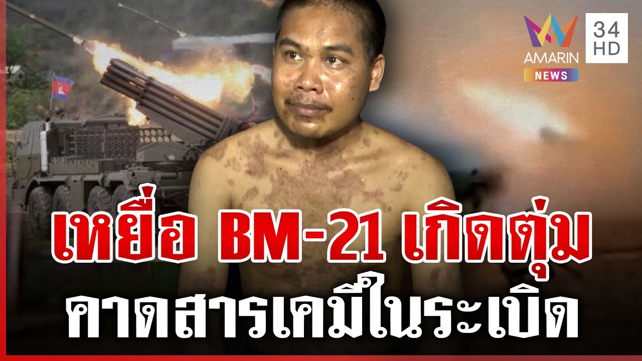 อุบลฯ ระทมหนักเขมรเผาไม่หยุด ช็อกเหยื่อ BM-21 เกิดตุ่มพุพอง | ทุบโต๊ะข่าว | 25/02/69