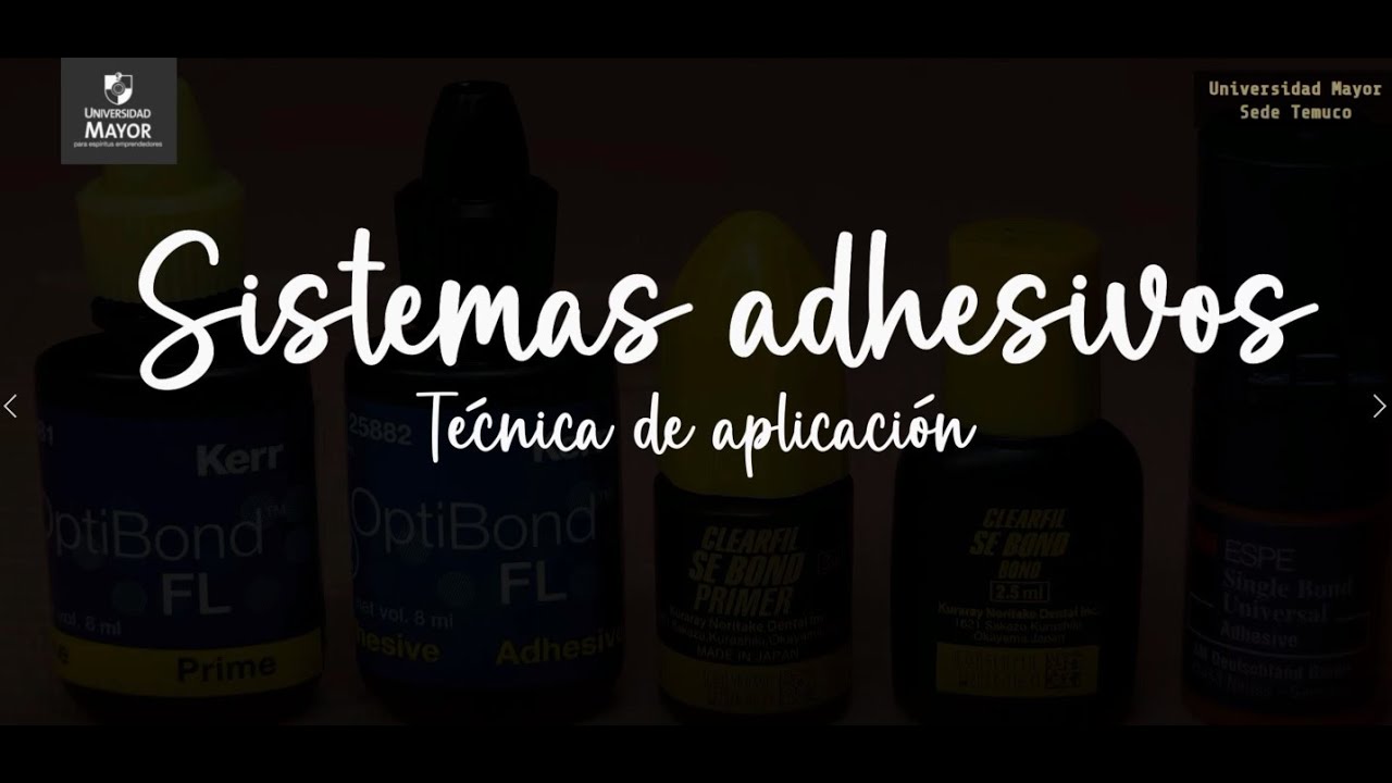 Sistemas adhesivos | Técnica de aplicación