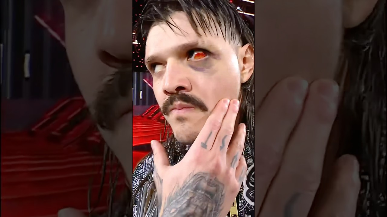 Just throw the whole eye away at this point 😮&zwj;💨👁️ #WWERaw