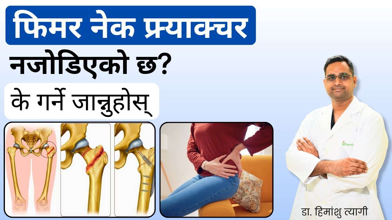 फिमर नेक फ्र्याक्चर नजोडिएको छ? के गर्ने जान्नुहोस् | Femur Neck fracture in Nepali