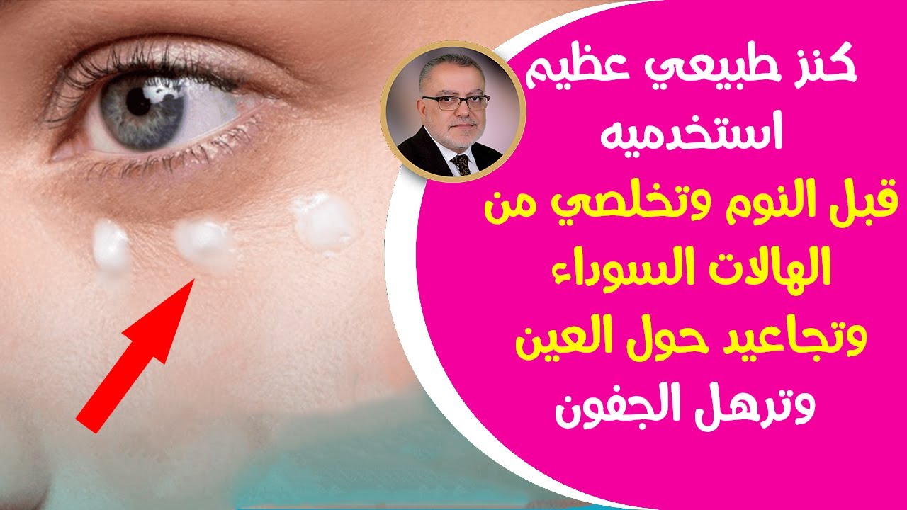 طريقة التخلص سريعامن الهالات السوداء مكون طبيعي يخلصك من التجاعيد حول العين والهالات السوداء والترهل