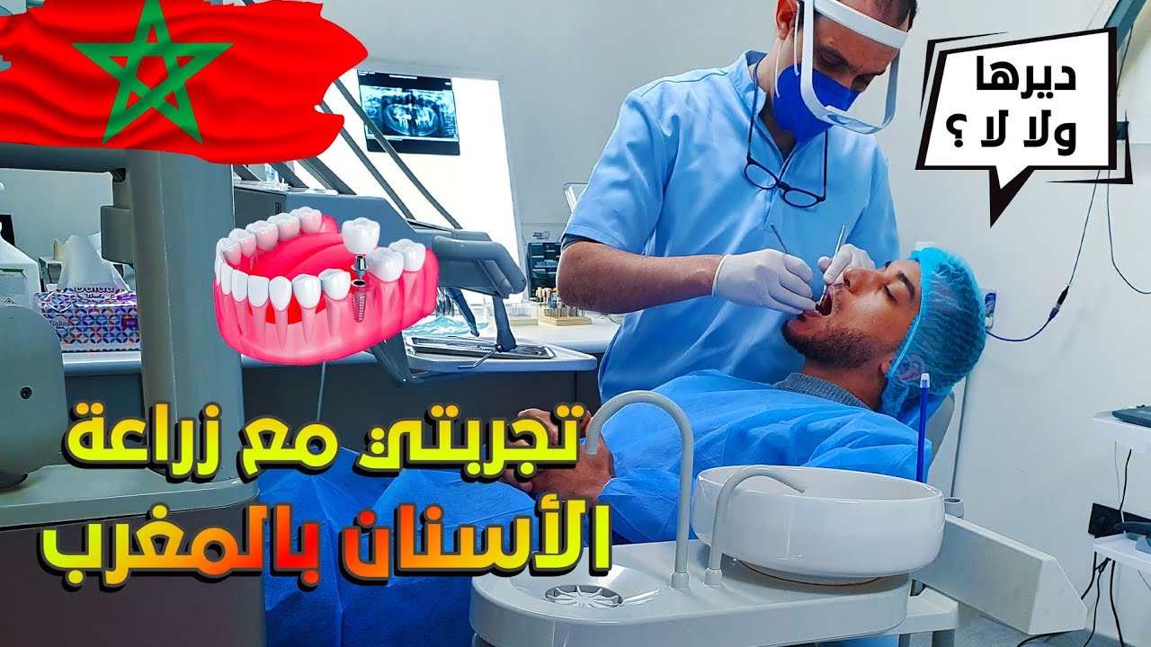تجربتي مع زراعة الأسنان بالمغرب 🦷 معلومات أول مرة غتسمعها | my experience with dental implant