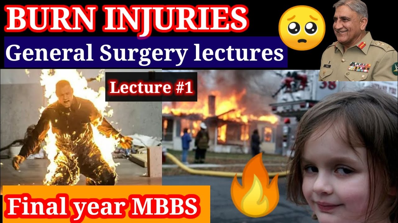 Burn injury. General surgery lecture #1. Final year MBBS #SURGERY #BURN classification rule of nine