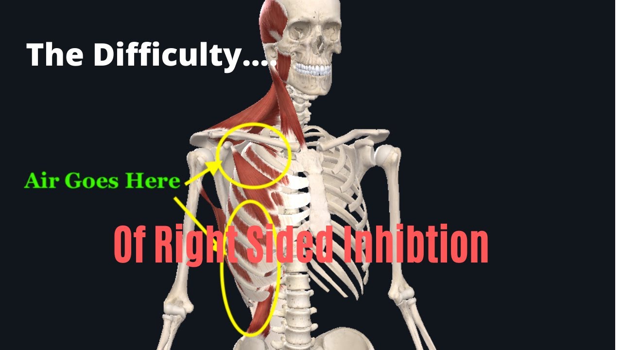 The Massive Amounts of Right Thoracic Musculature That Needs Inhibiting