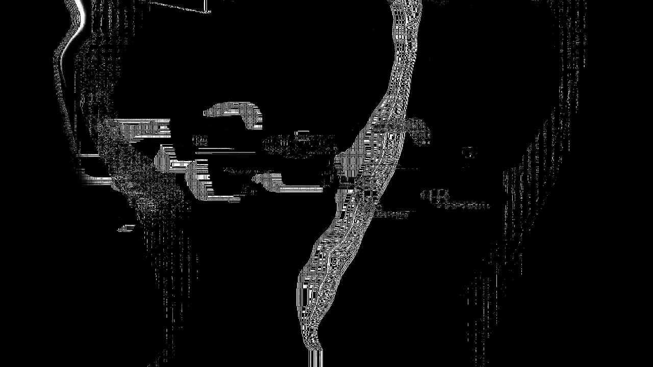 LORN - DRAWN OUT LIKE AN ACHE