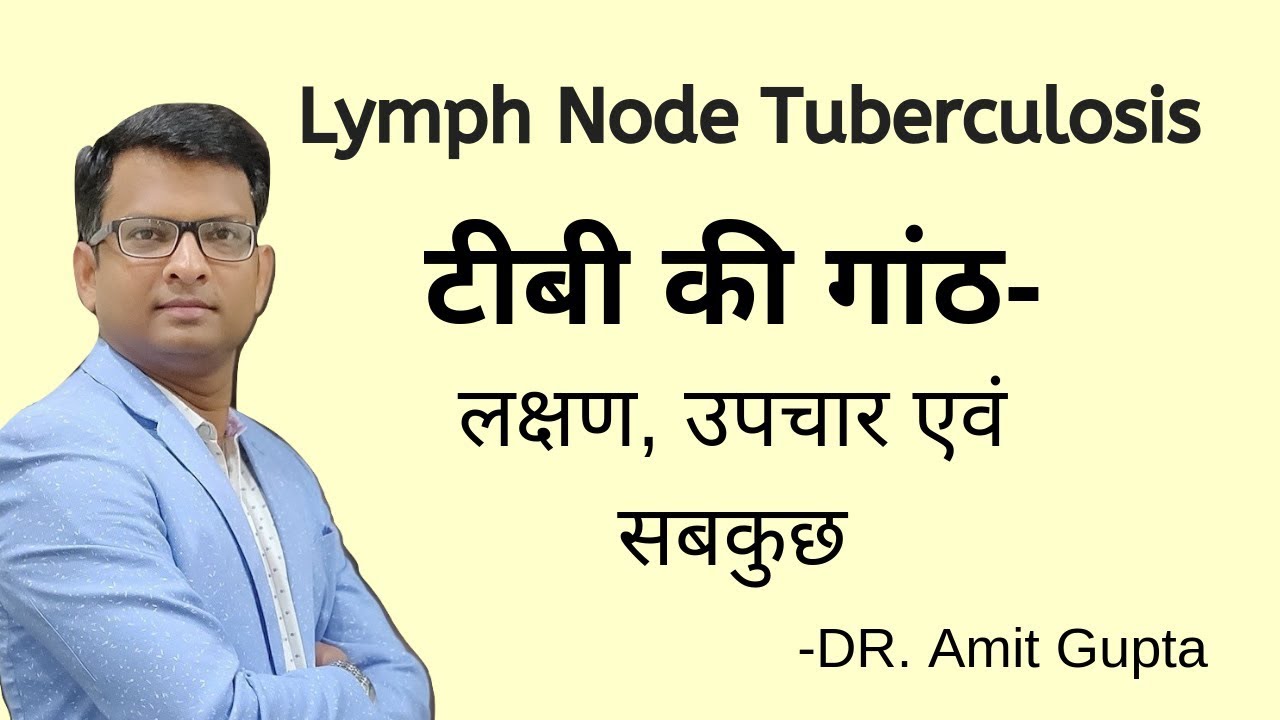 टीबी की गांठ- लक्षण, उपचार । Lymph Node Tuberculosis- cause, symptoms & treatment