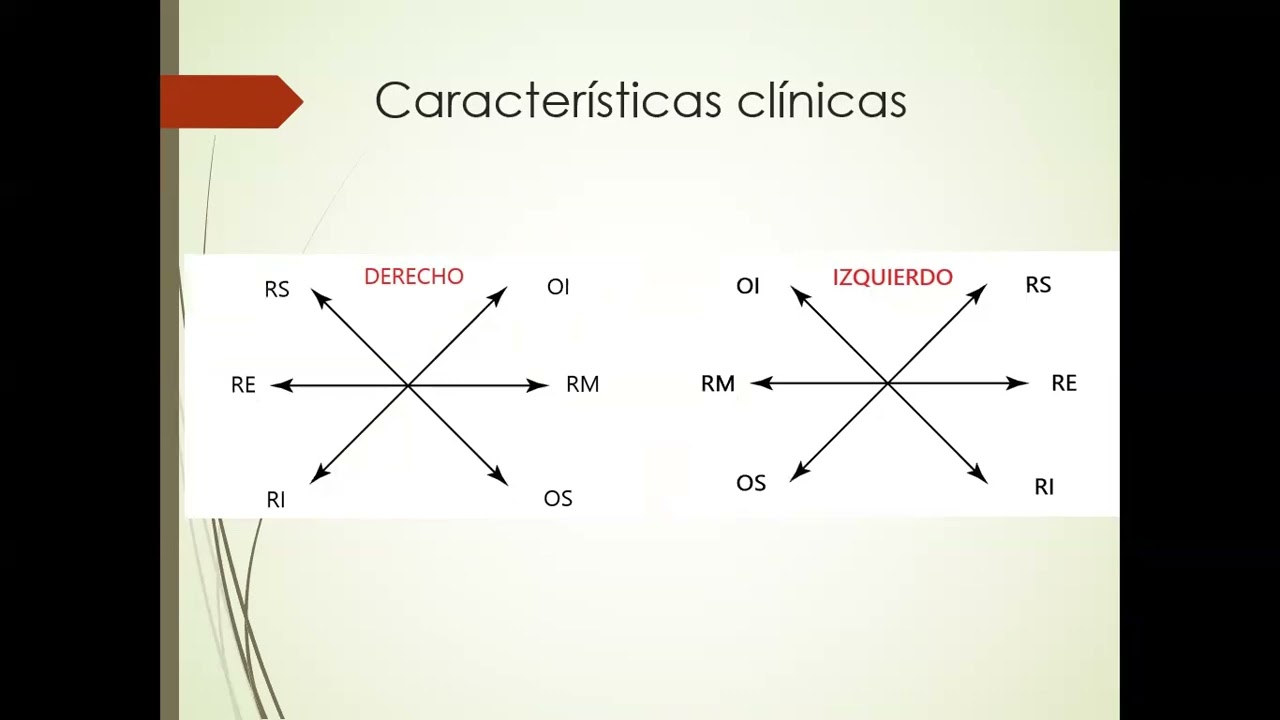 TELECAPACITACION PARÁLISIS OCULOMOTORAS DR  ALFONSO CÁRDENAS MERINO
