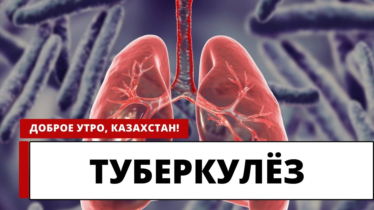 ТУБЕРКУЛЁЗ: ЧТО НУЖНО ЗНАТЬ О ЛИЧНОЙ БЕЗОПАСНОСТИ