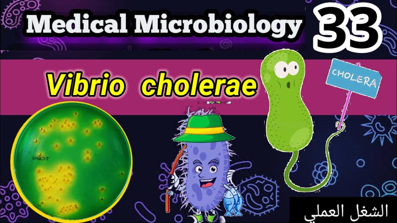 vibrio cholerae شرح الشغل العملي
