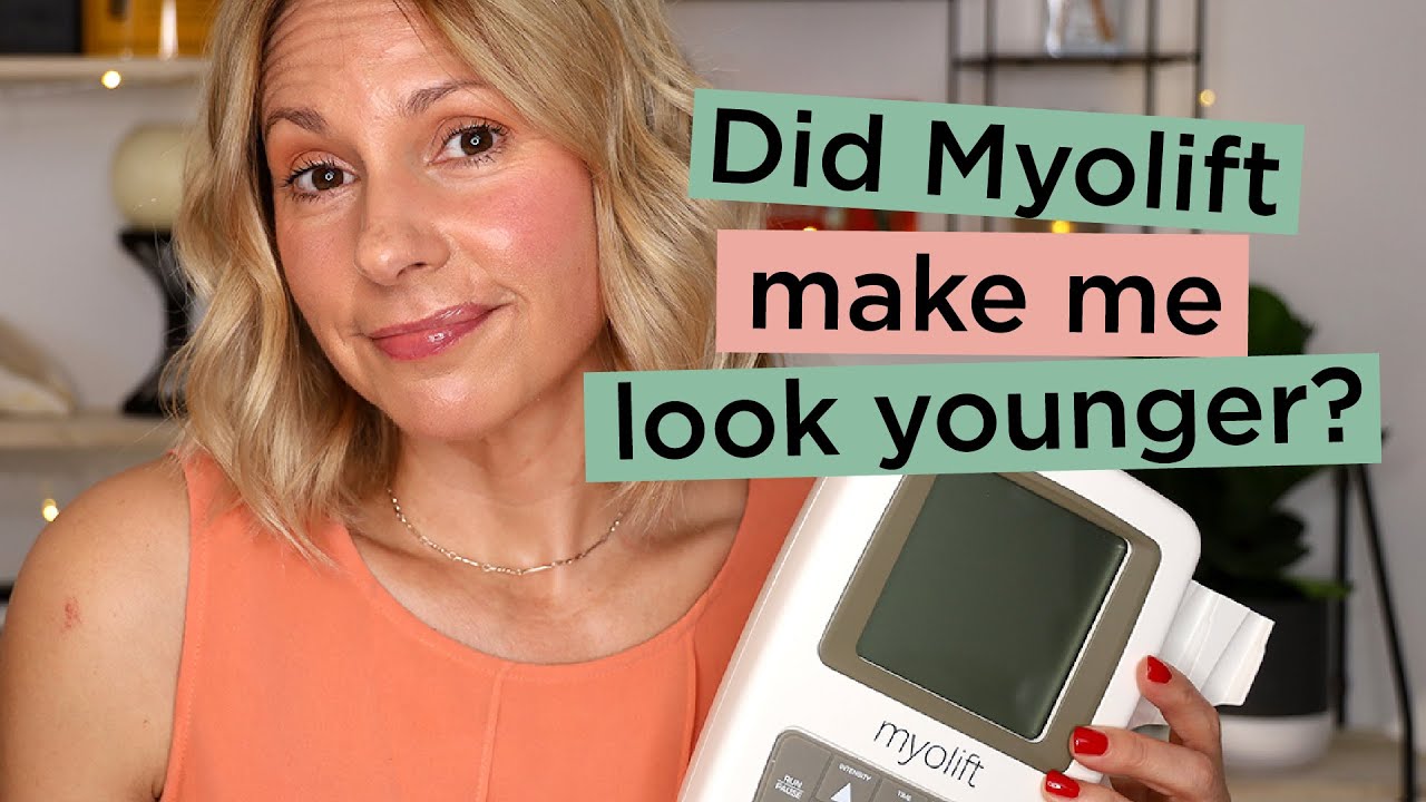 Myolift Mini 60-Day Results - Before & After Photos | Skin Obsessed Mary