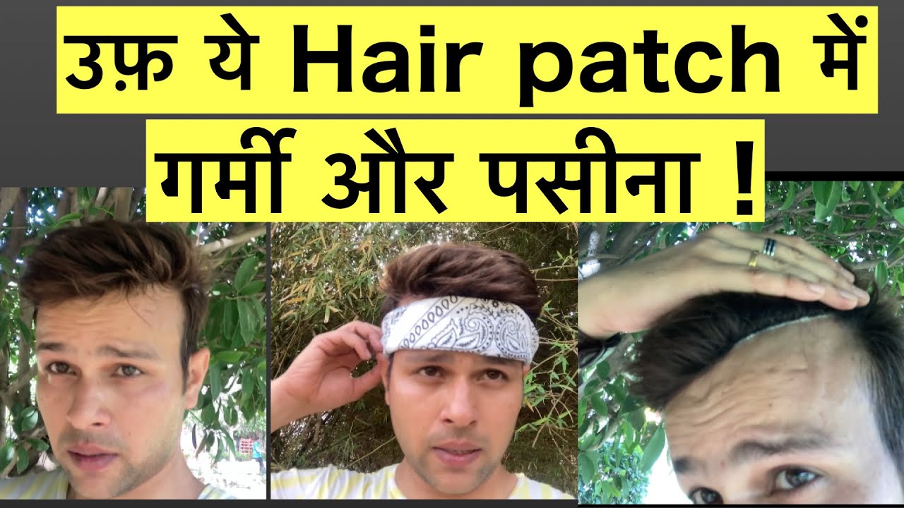 HAIR PATCH SWEATING || HAIR PATCH FOR MEN || HAIR PATCH IN SUMMERS ||