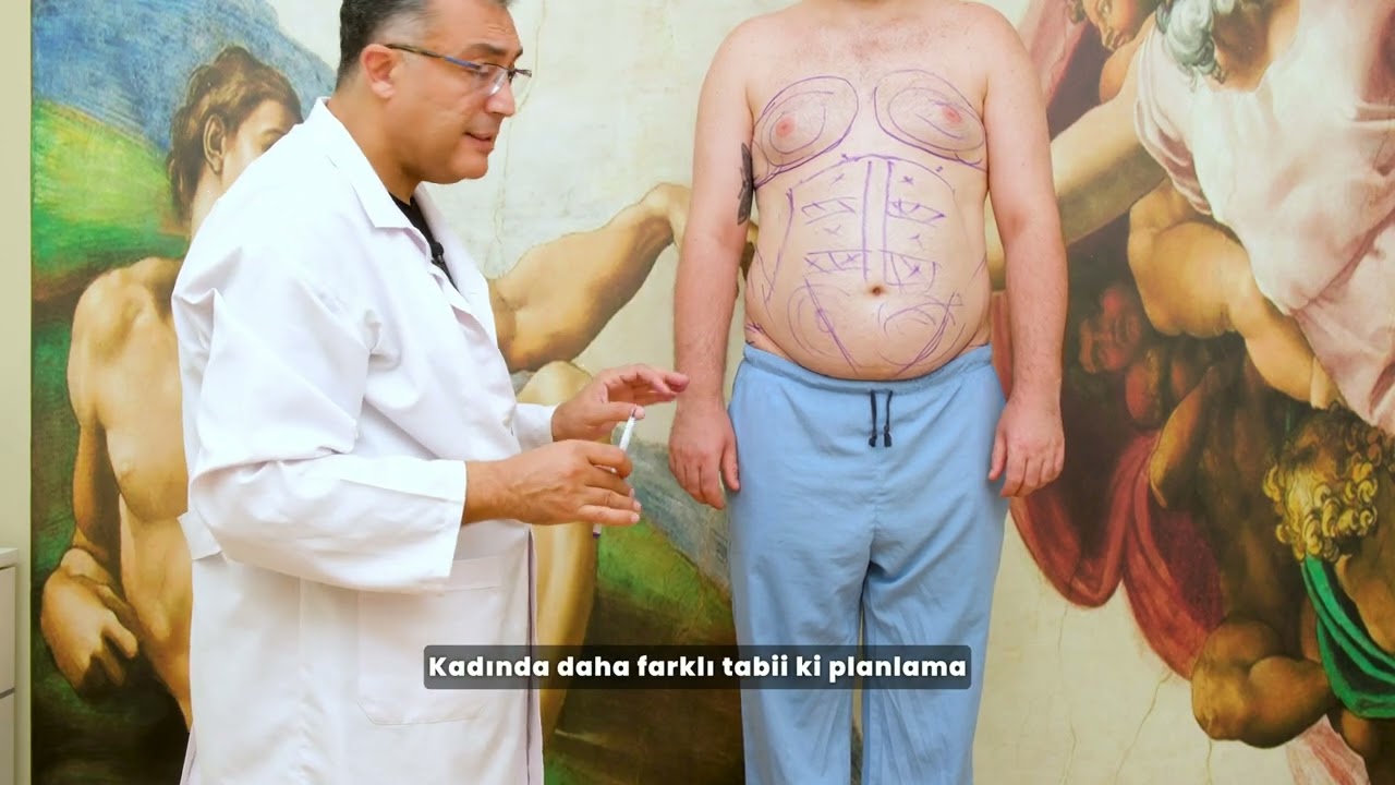 Erkek Kombine Yağ Aldırma ve Jinekomasti Ameliyatı Planlaması