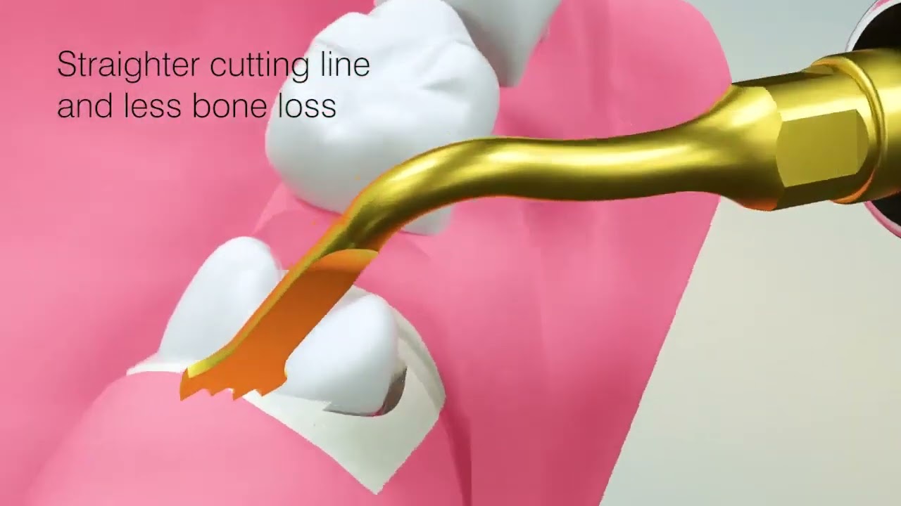 DTE Surgery X Woodpecker Аппарат хирургический ультразвуковой