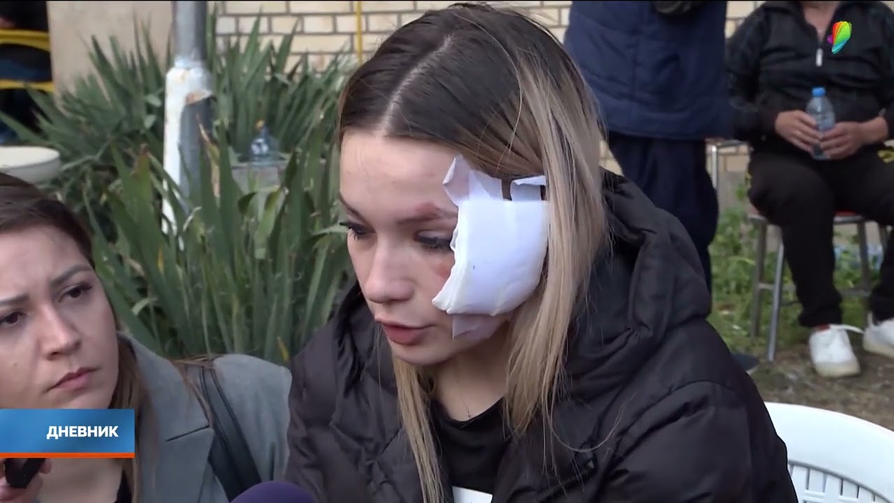 Ministar zdravlja Severne Makedonije: Svi povređeni u stabilnom stanju