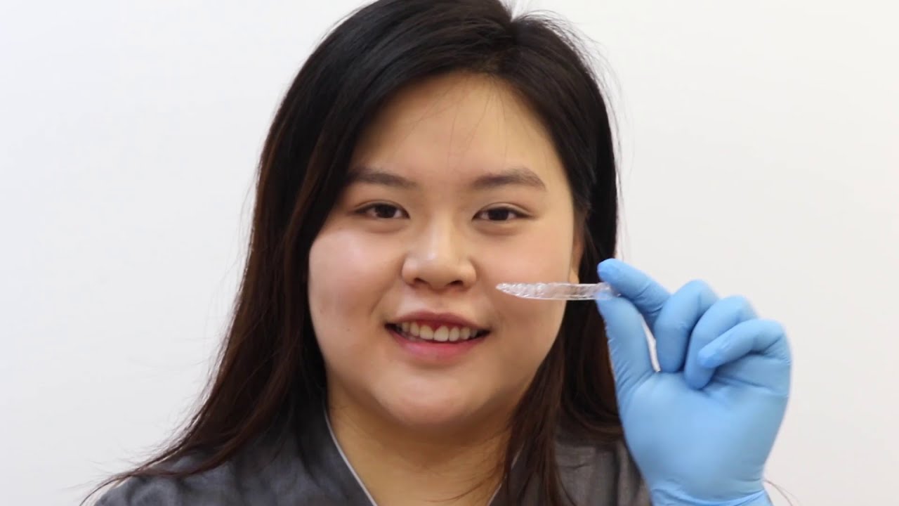 How to use aligners/Invisalign&reg;  (Orthodontic treatments)