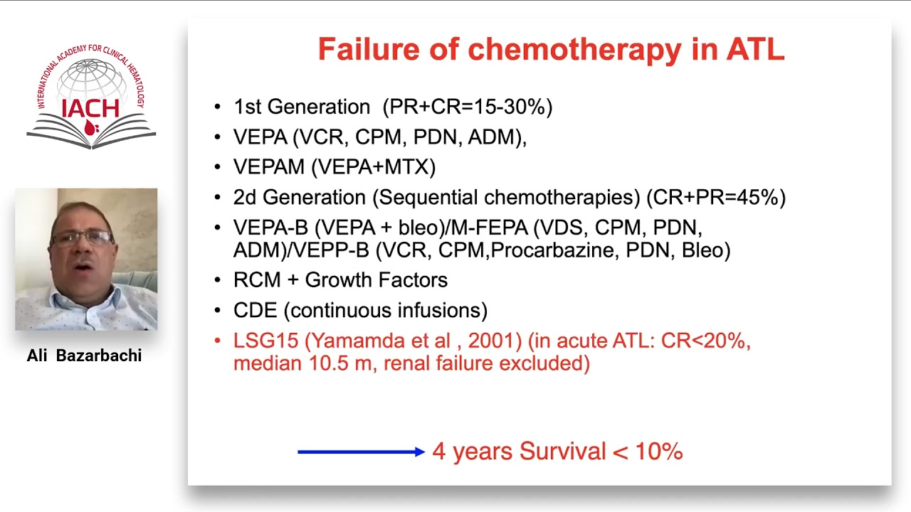 HTLV-1 associated malignancies: from diagnosis to treatment