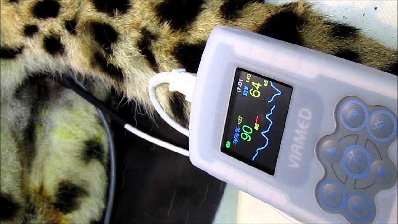 Thames Medical's VM-2160 Pulse Oximeter and UYB Sensor