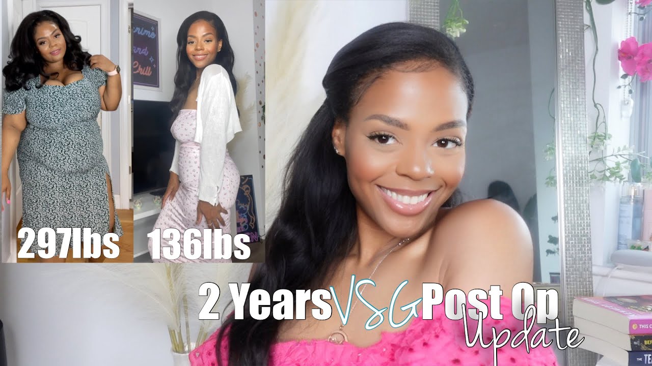 VSG 2 YEARS POST OP UPDATE: MY JOURNEY, WEIGHT LOSS MAINTENANCE + Q&A
