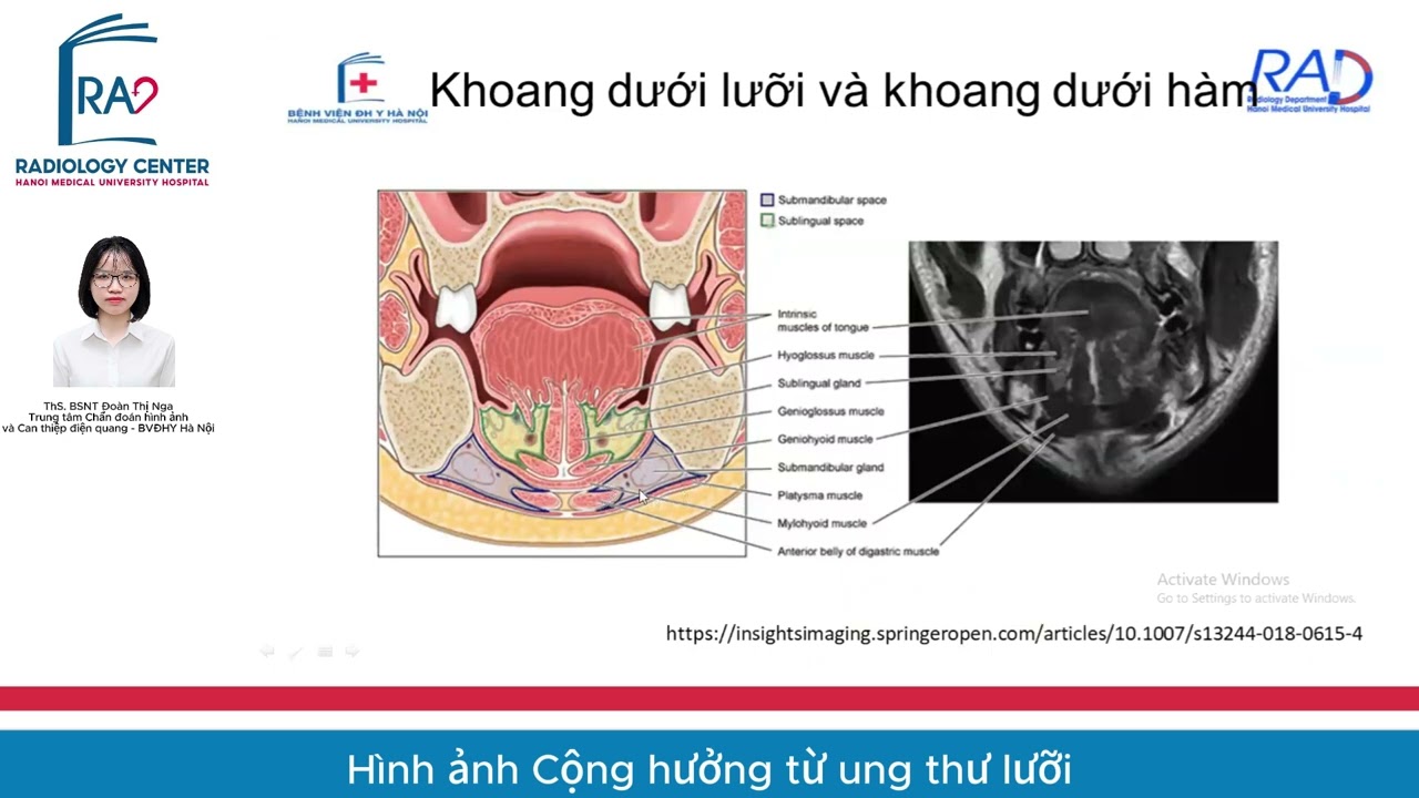 HÌNH ẢNH CỘNG HƯỞNG TỪ UNG THƯ LƯỠI
