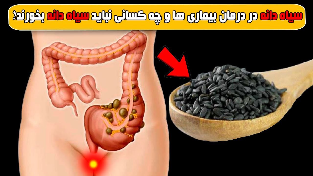 چه کسانی نباید سیاه دانه بخورند!