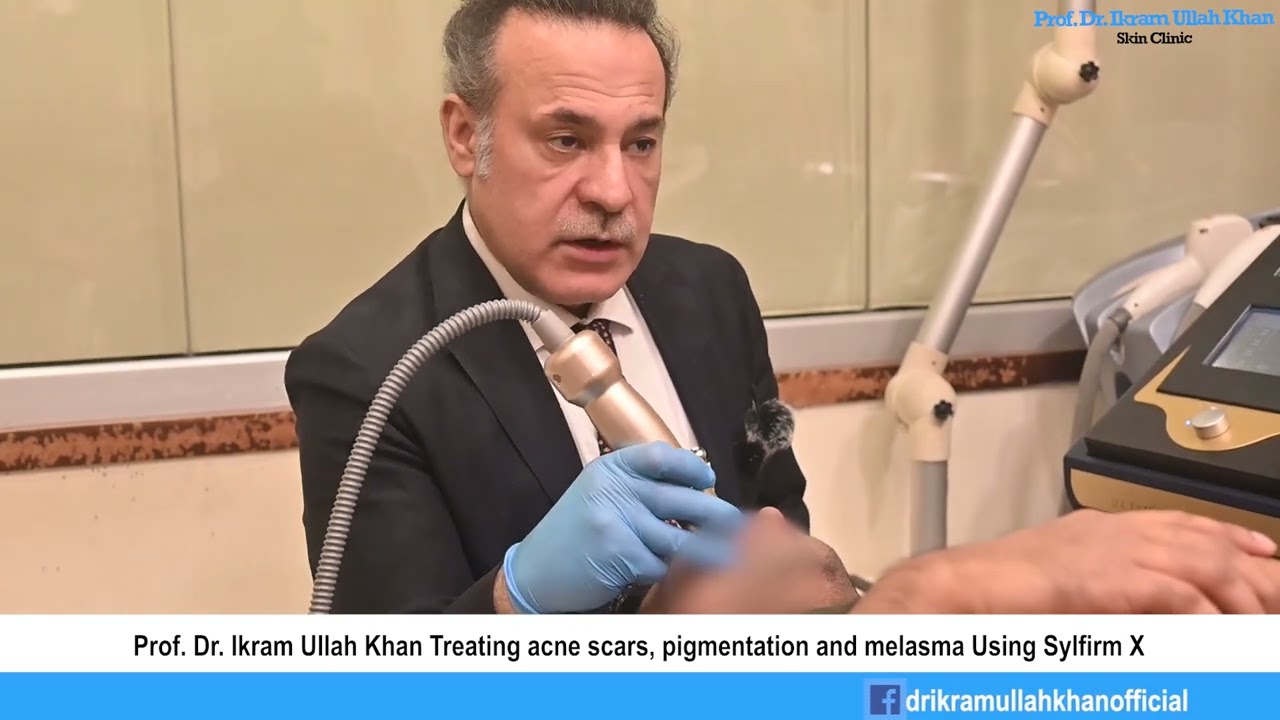 Total Skin Revival: Sylfirm X Laser Tackles Melasma, Acne Scars, Pores! #melasma #ancescars #laser