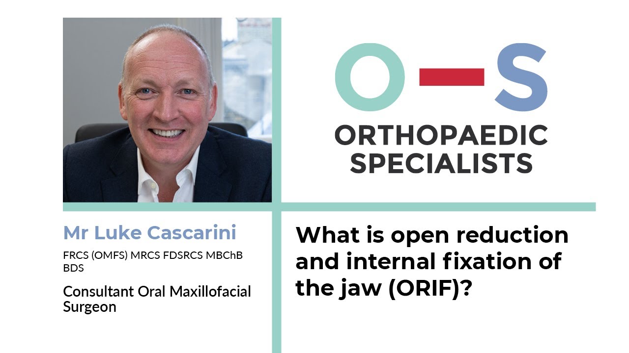 What is open reduction and internal fixation of the jaw (ORIF)?