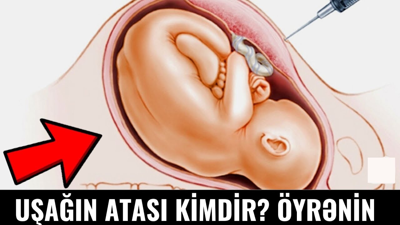 Ana Bətnində Uşağın ATALIQ TESTİ