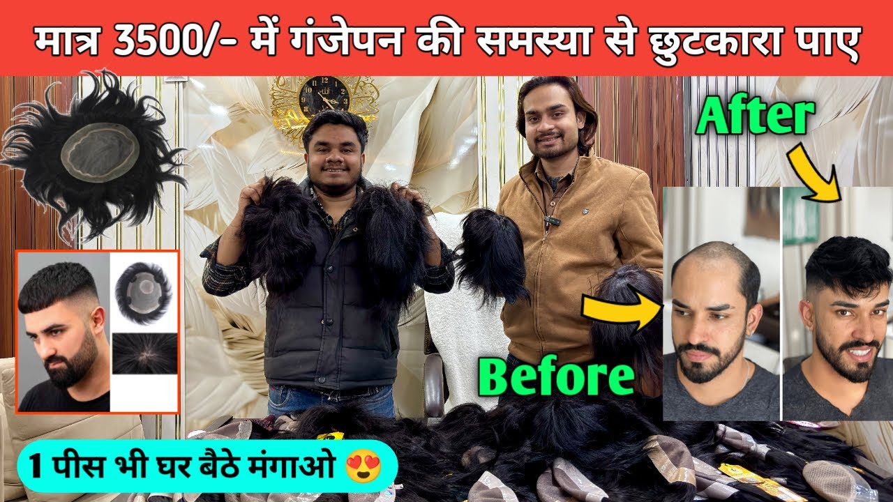 Hair Patch Wholesale Market In Delhi | Hair Patch Wholesale Supplier |Cheapest hair wig market delhi