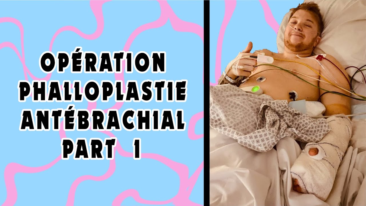 Opération 1 phalloplastie antébrachial part  1/7 // Ftm transgenre français // CRAZYDEN !