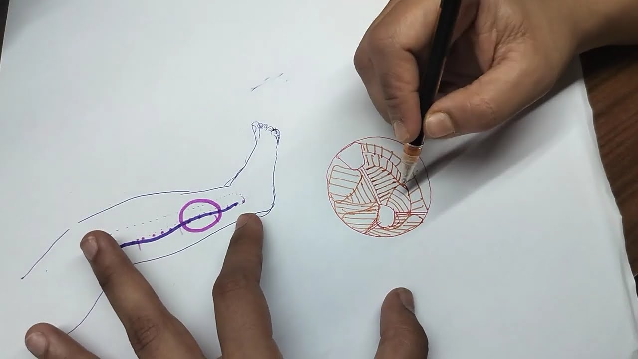 Free fibula flap marking
