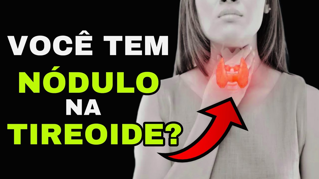 7 SINAIS PERIGOSOS de um NÓDULO na TIREOIDE (Sintomas de Câncer na Tireoide)