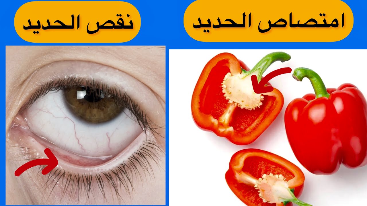 اعراض نقص الحديد في الجسم ؟  كيف ترفع امتصاص الحديد بالفلفل ؟ الفئات المعرضه لفقر الدم