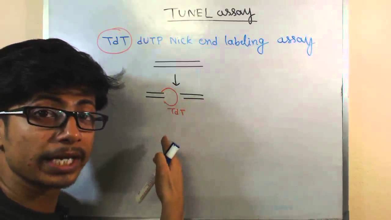 Tunel assay apoptosis