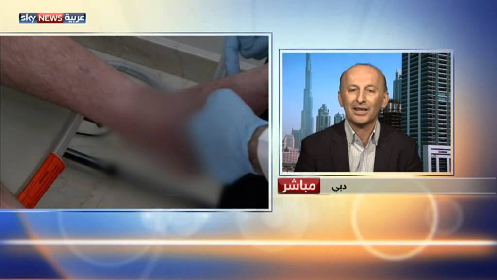 جراحة رائدة لترميم عظام الكاحل
