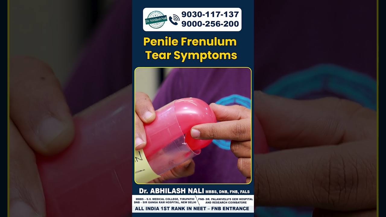 Best Solution for Tight Frenulum || Dr Abhilash Nali || #shorts #ytshorts #drabhilash #healthtips