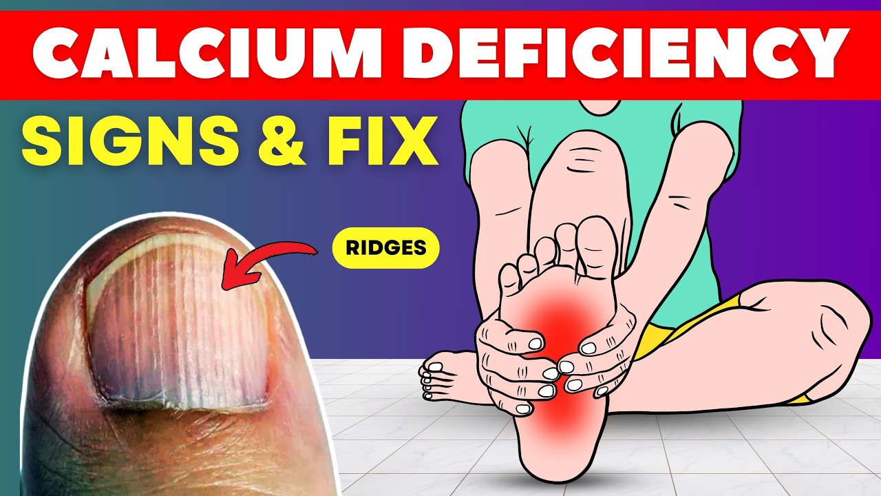 Your Body is Screaming for Calcium! Don't Ignore These 10 Signs