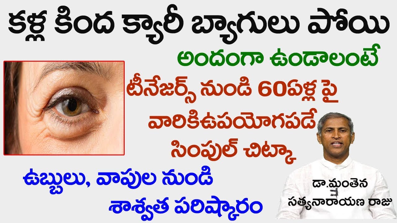 కళ్ల కింద ఉబ్బులు,వాపులు పోవాలంటే?|Best Way to Remove Eye Bags|Dr.Manthena Satyanarana|Good Health