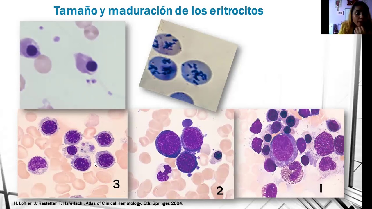 Laboratorio de Hematología. Frotis de sangre periférica, citometría hemática