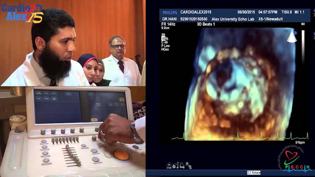 How to perform 3D-TTE exam 