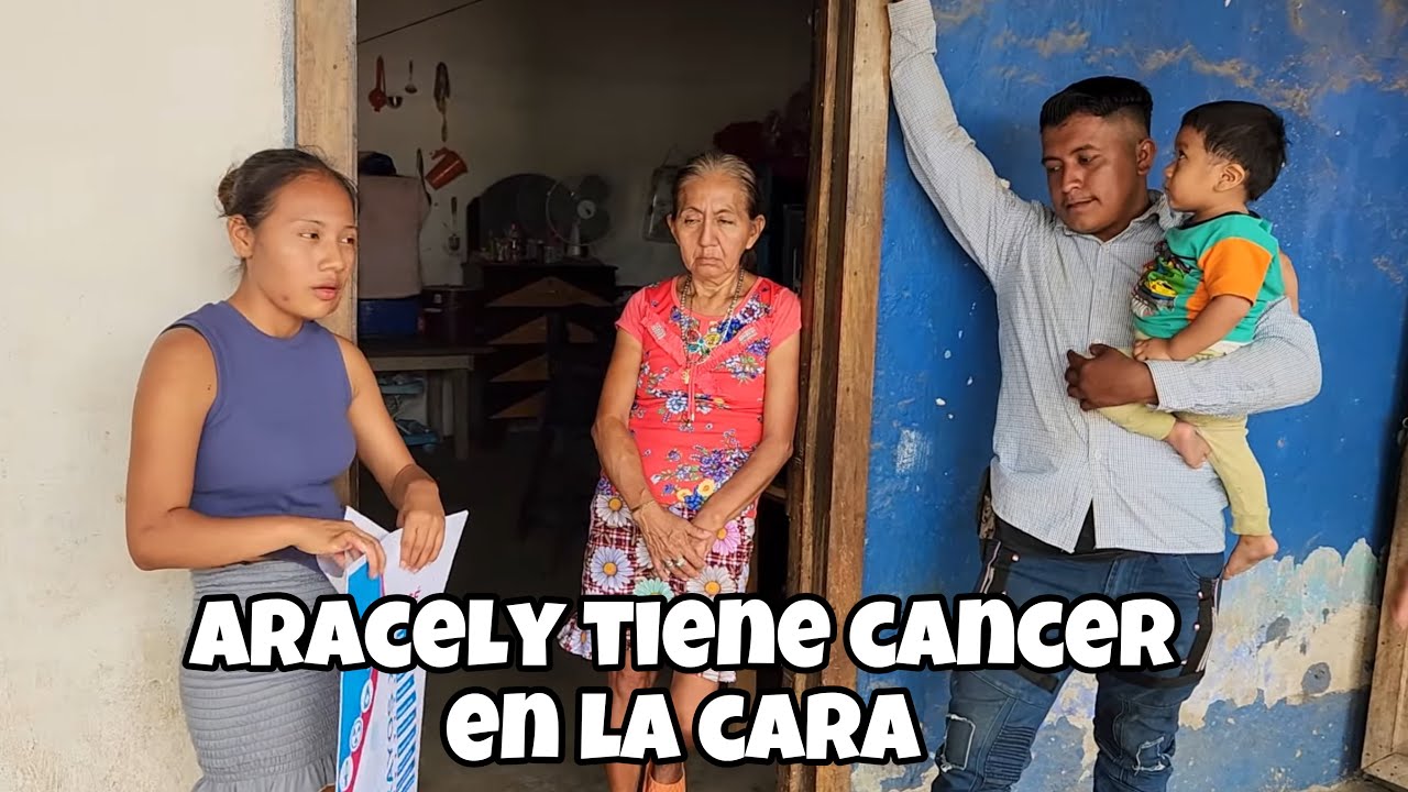 Aracely necesita una operación  de urgencia/ le salió tremendo grano en la cara