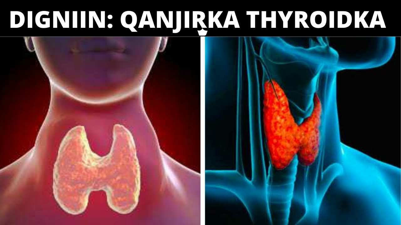 5 CALAAMADOOD OO DIGNIIN AH OO  QANJIRKA TAYRODHKA LA XARIRO