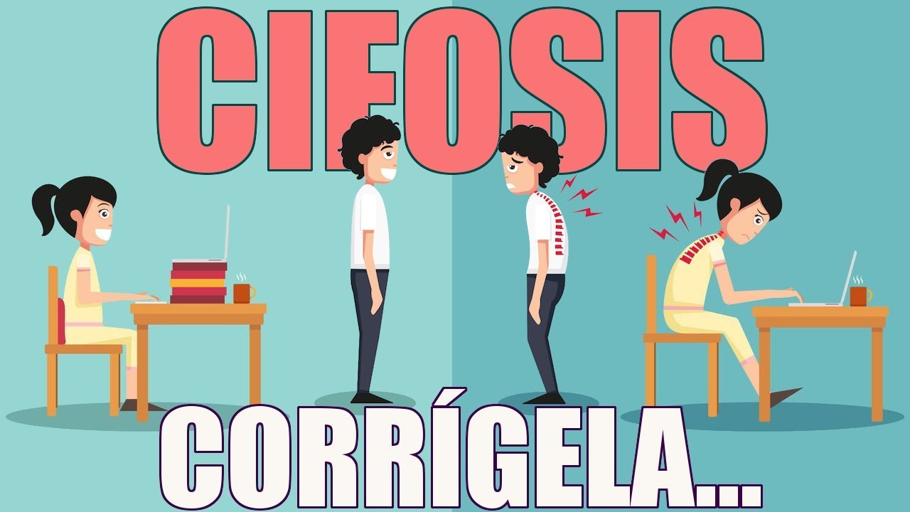 Corrige la CIFOSIS en 3 pasos | Higiene Postural