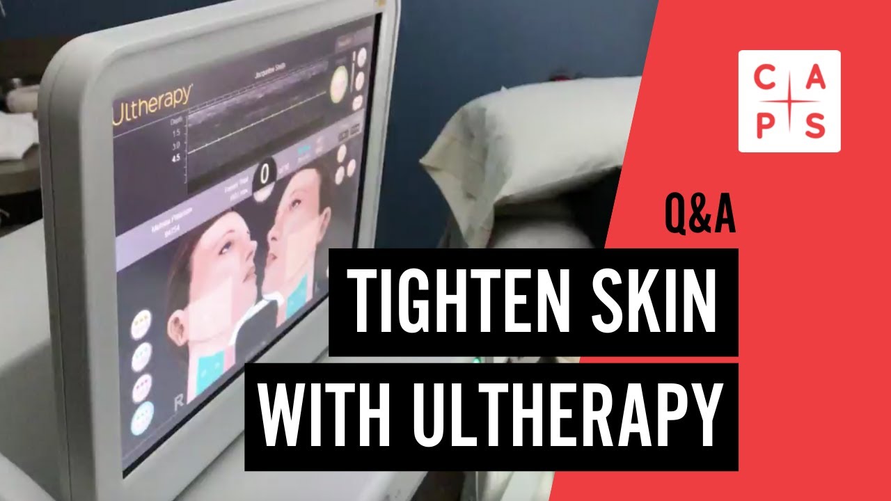 How Ultherapy Lifts & Tightens by Building Collagen
