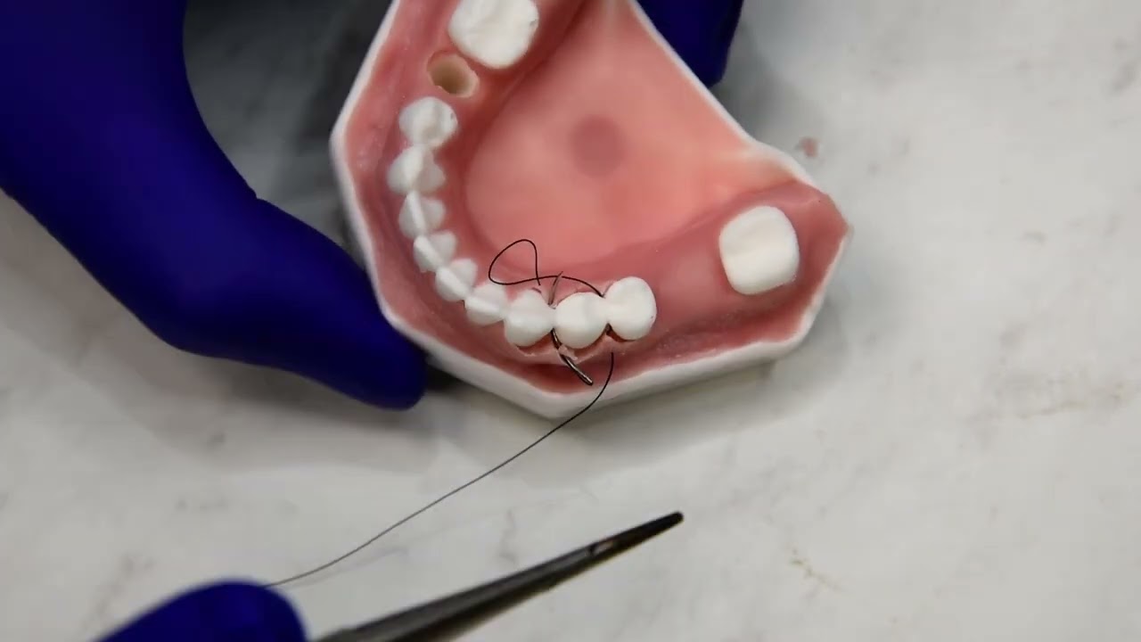 Papilla Sling