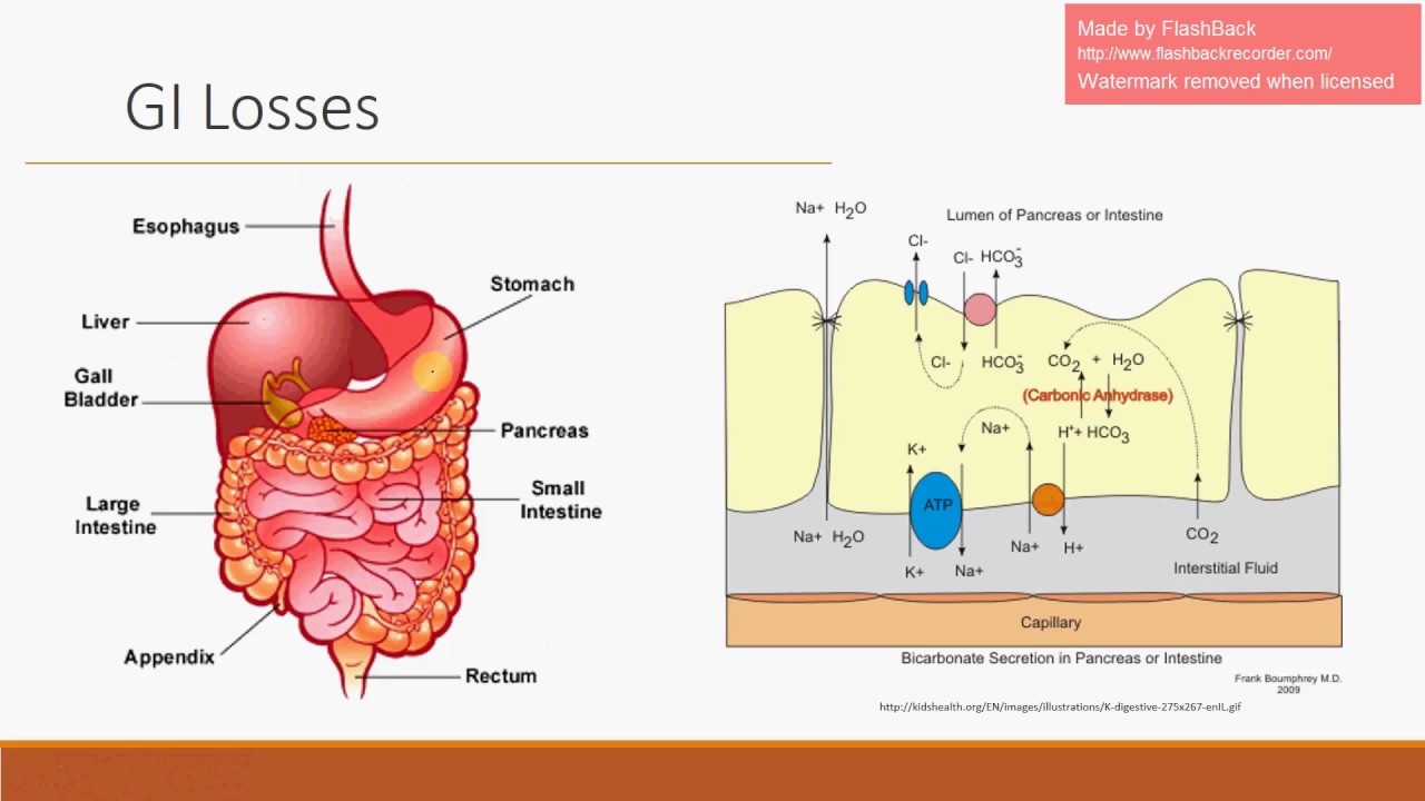 Non-Anion Gap Metabolic Acidosis - GI/GU Losses (See updated video)