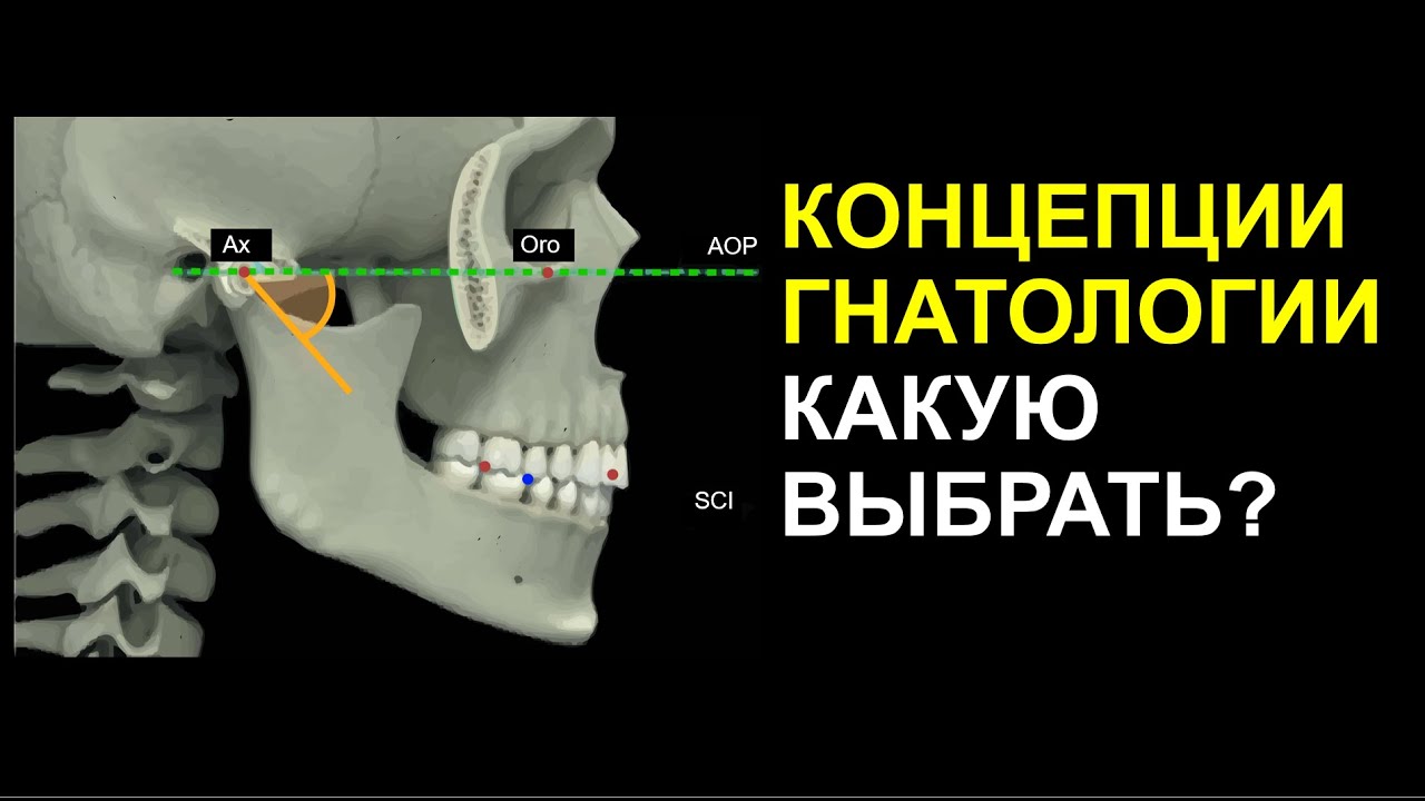 КОНЦЕПЦИИ ГНАТОЛОГИИ КАКУЮ ВЫБРАТЬ?