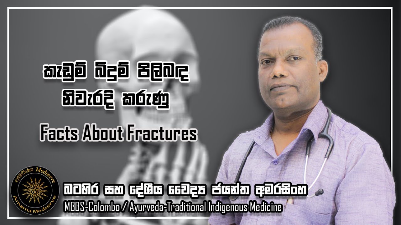 කැඩුම් බිදුම් පිලිබඳ නිවැරැදි කරුණු | Facts About Fractures