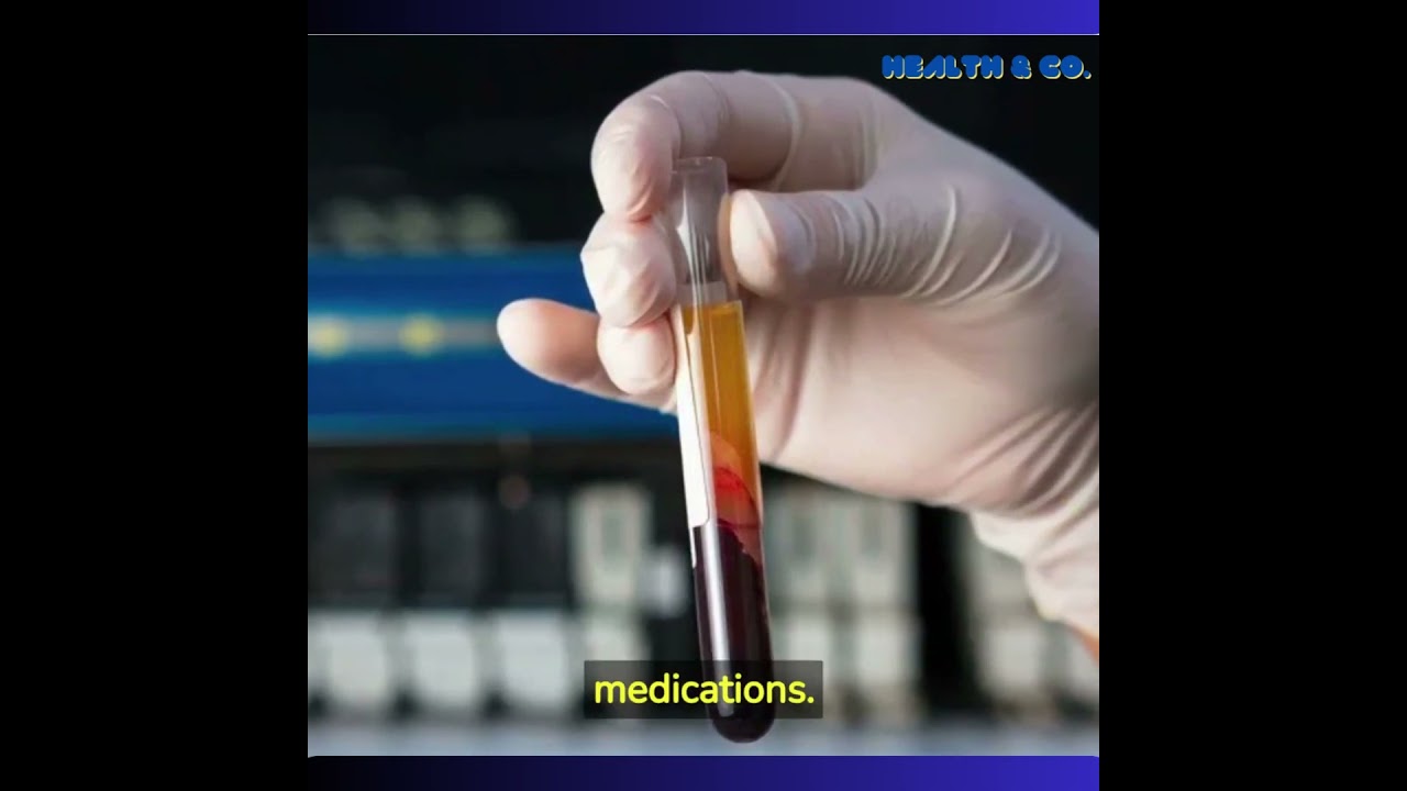 How many types of blood test?#bloodtests #pathology #bloodcount #lipidprofile #kidneyproblem #sgpt