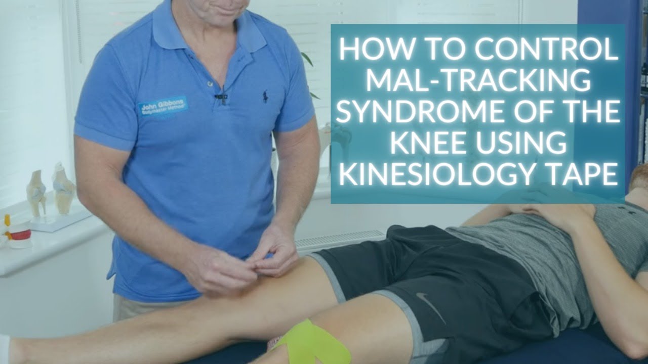 How to control Mal-Tracking Syndrome of the Knee using Kinesiology Tape