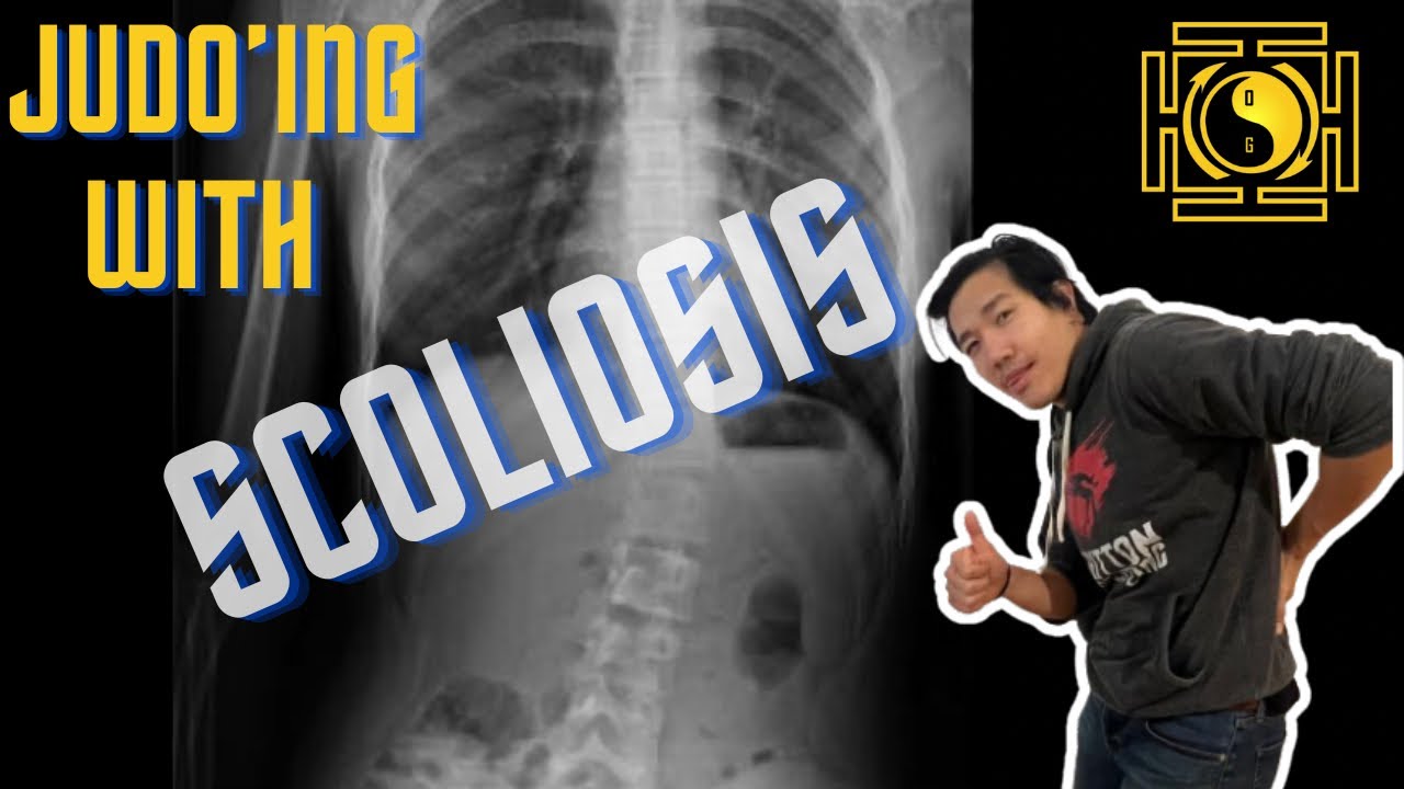 How i Judo w Scoliosis